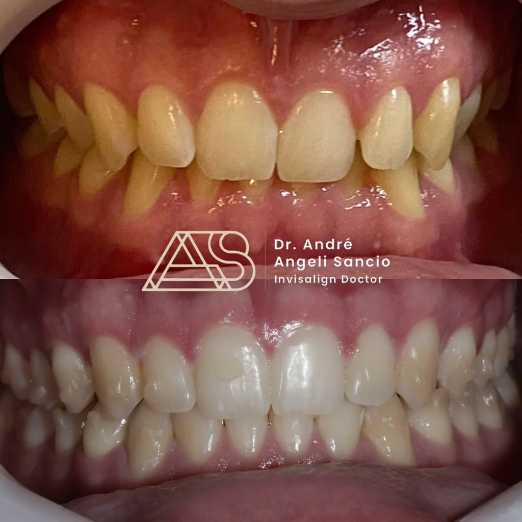 drandre.sancio__2024-12-13T150842.000Z copiar