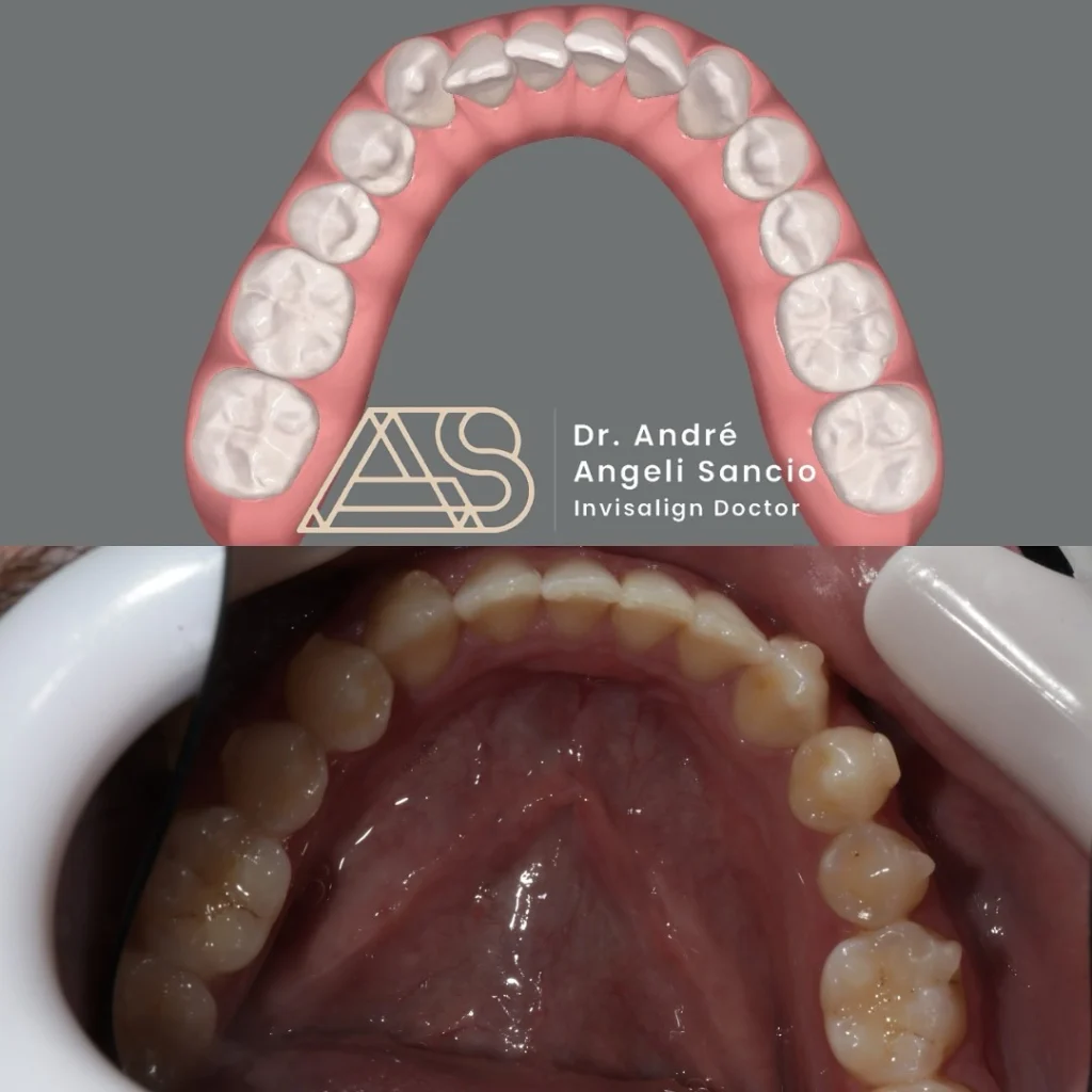 drandre.sancio__2024-12-13T150842.000Z_1 copiar