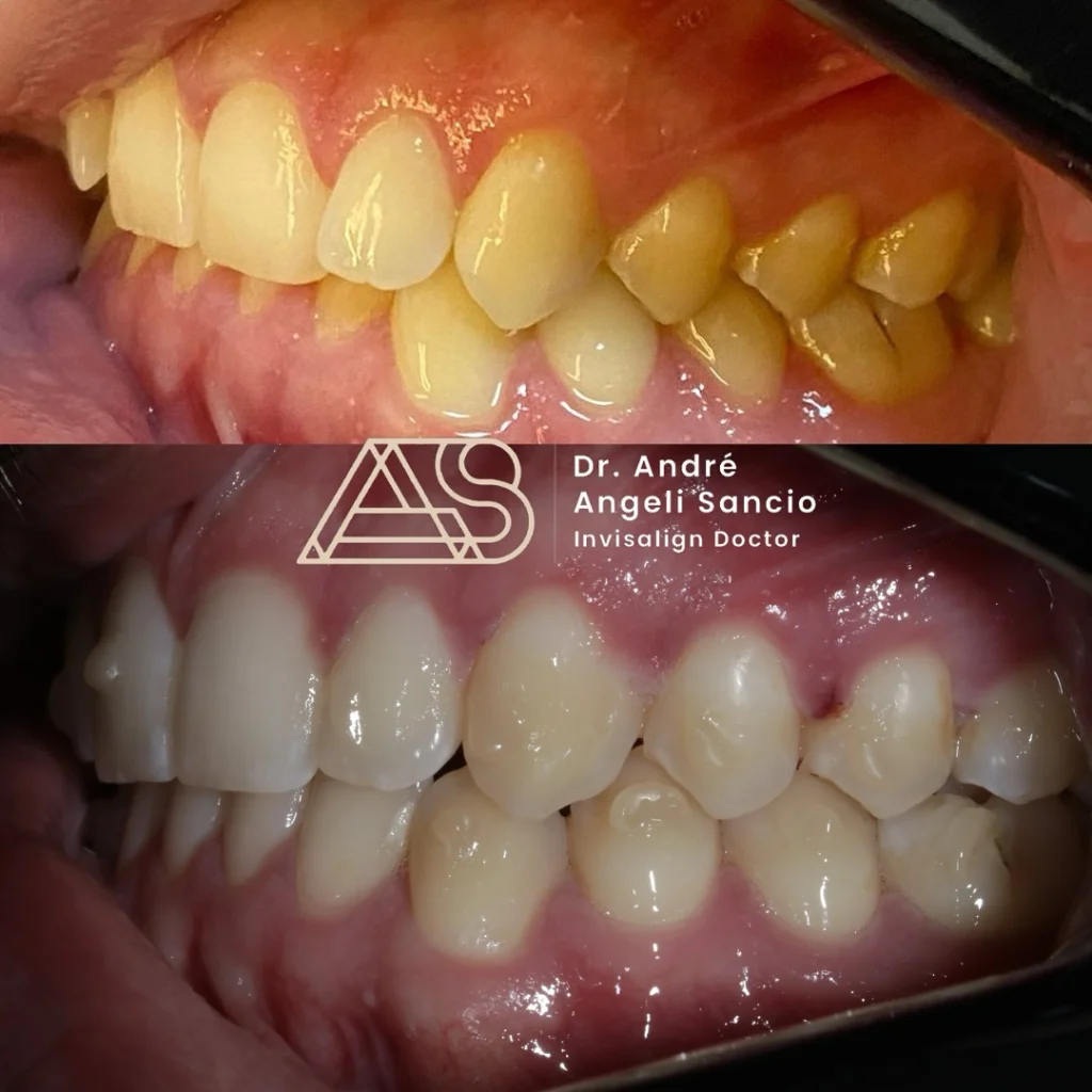 drandre.sancio__2024-12-13T150842.000Z_2 copiar