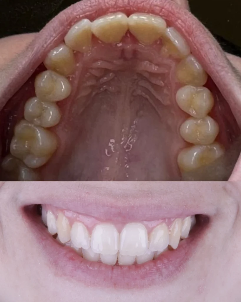 drandre.sancio__2026-02-18T134418.000Z_3 copiar