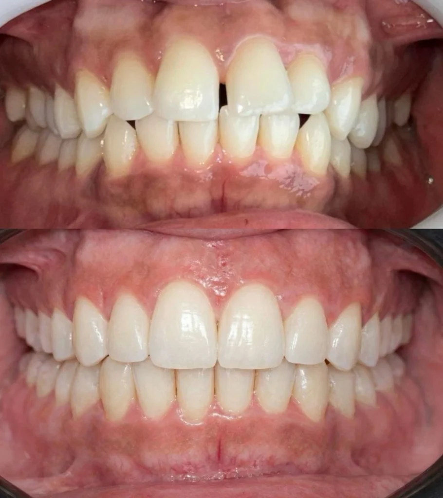 drandre.sancio__2026-02-24T213249.000Z copiar